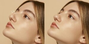 Illustrazione del naso umano utilizzata per spiegare la rinoplastica estetica e funzionale