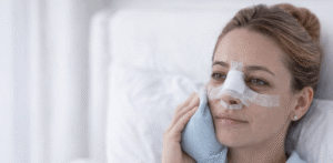 Rinoplastica post operatorio con splint nasale e ghiaccio per ridurre il gonfiore dopo l’intervento